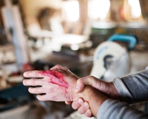 Reporting Injuries Suffered in a Construction Accident in Wyoming