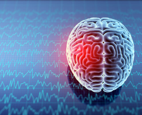 Fort Walton Beach, Florida, Is a concussion a serious injury?